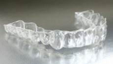 СИСТЕМА виправлення прикусу INVISALIGN